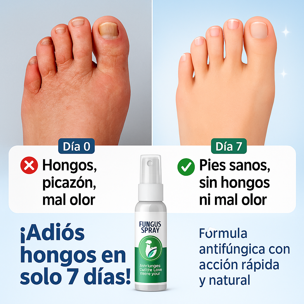 Spray para pie de atleta